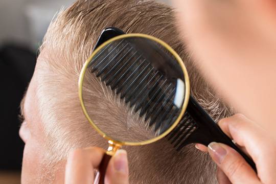 Признаки поврежденности мужских волос